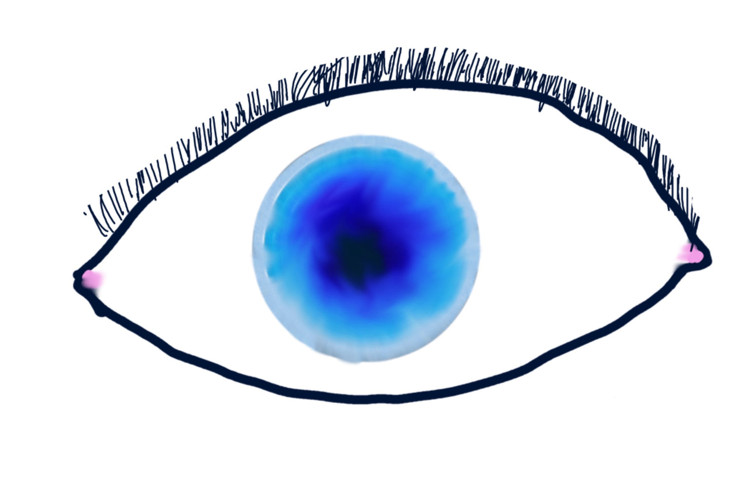 Sprit's Eye